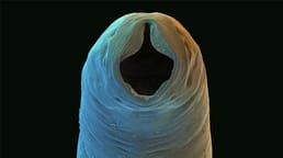 Como os ancilostomídeos deram aos sulistas uma má reputação?