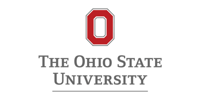 De witte stippellijnen op Amerikaanse snelwegen zijn 10 voet lang. En de ruimte ertussen is 30 voet lang. De meeste mensen denken dat ze maximaal 2‑4 voet lang zijn.