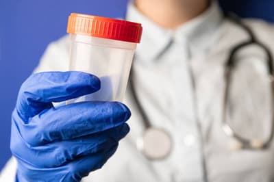 Can Anyone Donate Sperm?