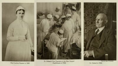 Who Popularized the Use of Surgical Gloves?