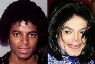 Warum war Michael Jackson besessen von seinem Aussehen?
