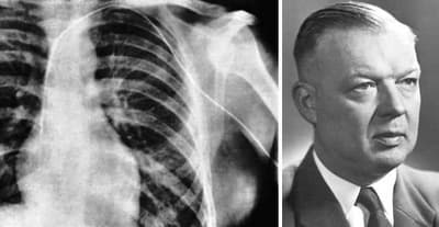 Who Performed the First Cardiac Catheterization?