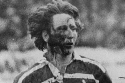 Насколько тяжёлой была травма Дж. П. Р. Уильямса в регбийном матче 1978 года против Новой Зеландии?