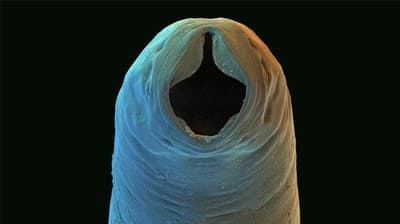 How Did Hookworms Give Southerners A Bad Reputation?