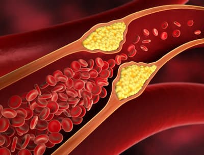 Cholesterol speelt een vitale rol in het menselijk lichaam. De lever maakt ongeveer 80% van de cholesterol in ons lichaam.