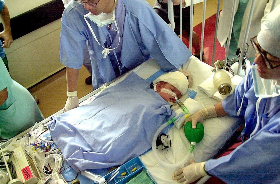 What Was the Longest Surgery and How Long Did It Take?