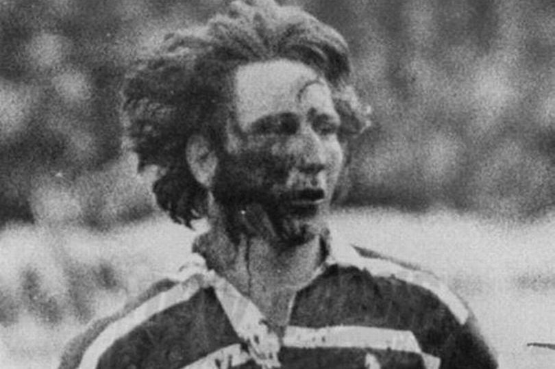 Quanto grave fu l'infortunio di JPR Williams nella partita di rugby del 1978 contro la Nuova Zelanda?