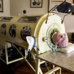 Who is the Last Person in the US to Live in an Iron Lung