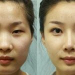 Many Chinese medical tourists who go to South Korea for inexpensive and high quality plastic surgery have difficulty re-entering China due to their passports photos not matching their new face post op.