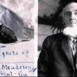 What Happened to Confederate Soldier, Willis Meadows’ War Wound?