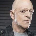 What Was the Rare Condition Michael Berryman Had?